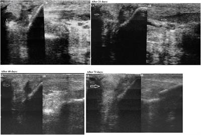 Gene Therapy Using Plasmid DNA Encoding Vascular Endothelial Growth Factor 164 and Fibroblast Growth Factor 2 Genes for the Treatment of Horse Tendinitis and Desmitis: Case Reports